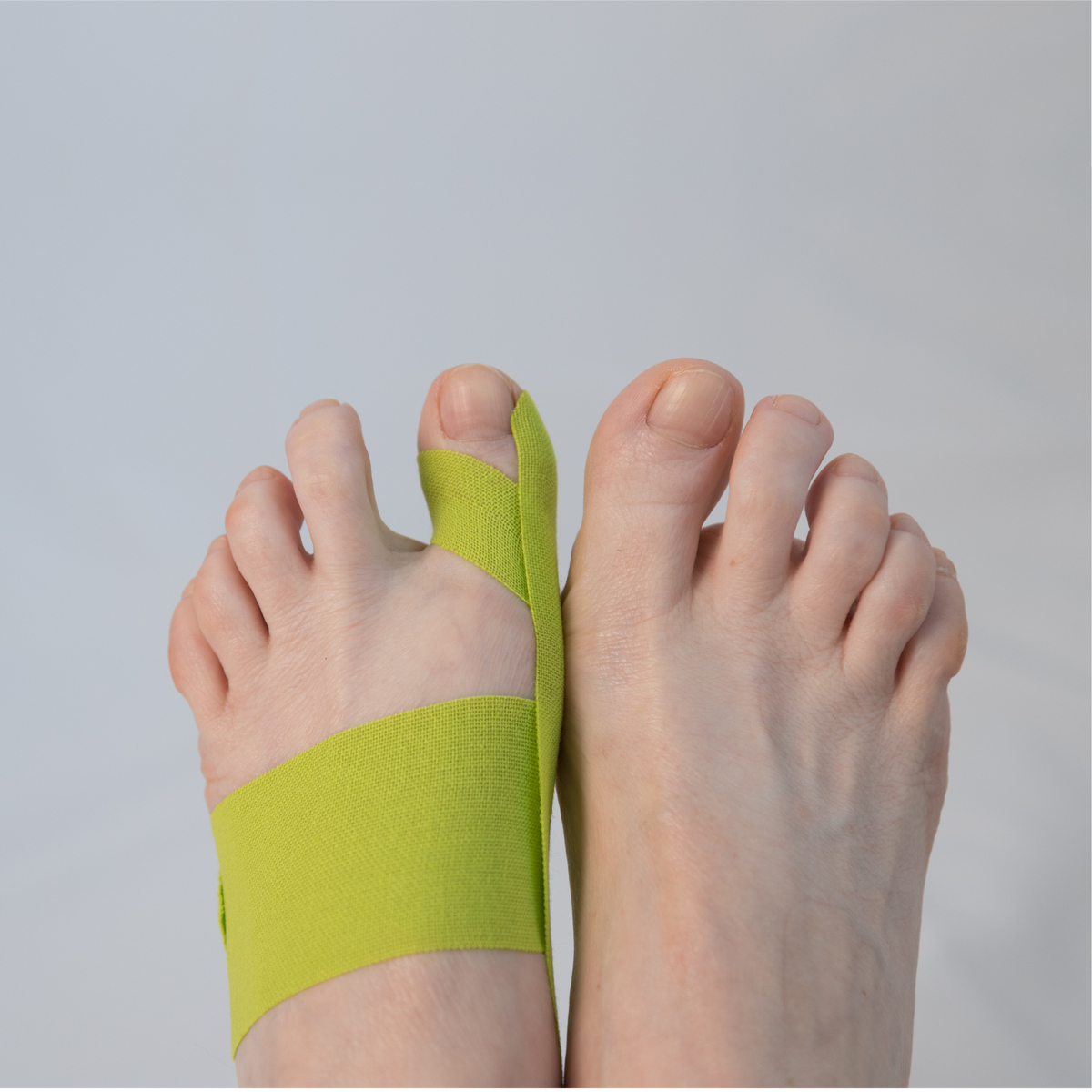 Hallux-Valgus Korrektur